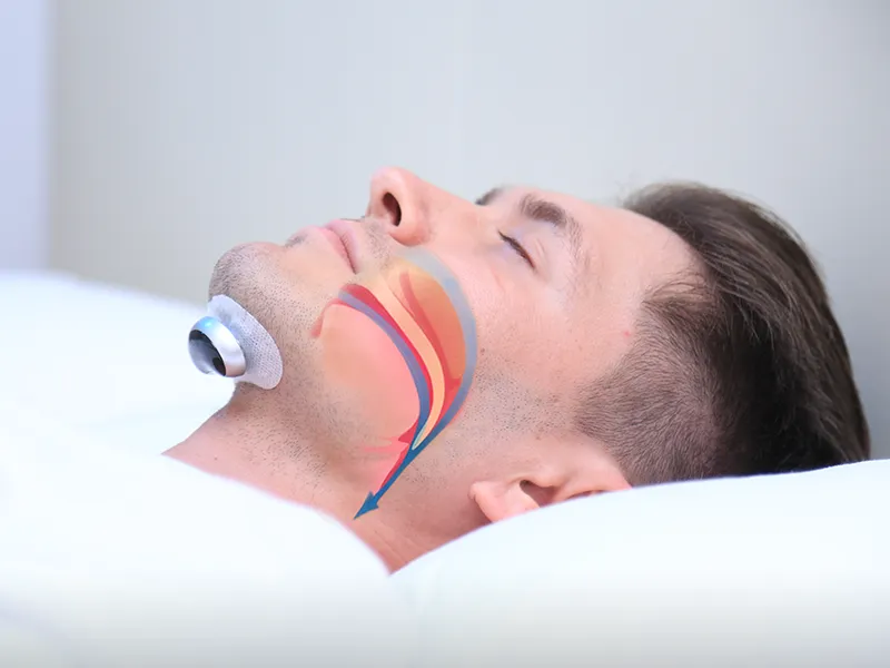 SilentEase Anti-Snoring Device – Smart Pulse Technology for Restful Sleep